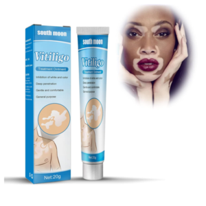 South Moon Vitiligo Treatment Cream In Pakistan